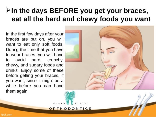 how to prepare for getting braces 8