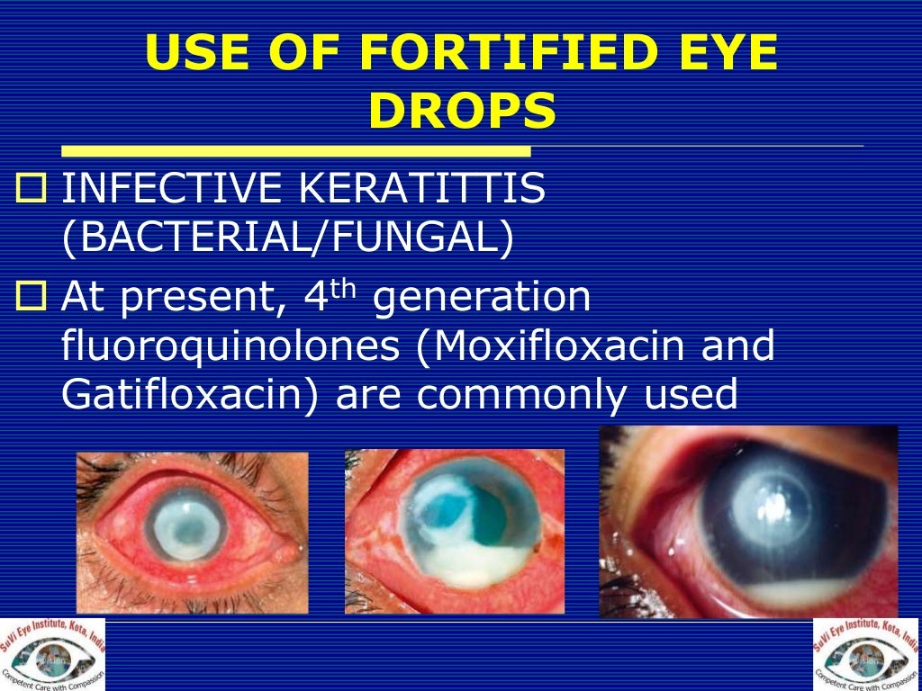 How to prepare fortified eye drops for management of infective
