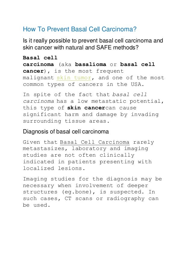 how to prevent basal cell carcinoma