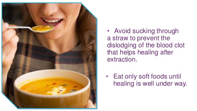 How To Prevent Dry Socket