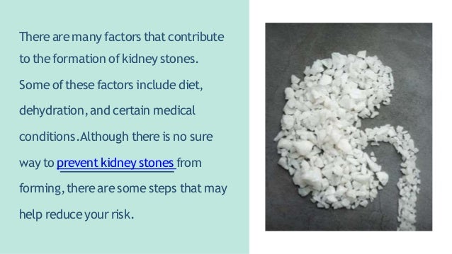 How To Prevent Kidney Stones? - Hiranandani Hospital | PPT