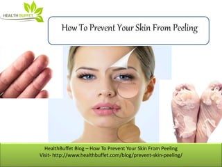 HealthBuffet Blog – How To Prevent Your Skin From Peeling
Visit- http://www.healthbuffet.com/blog/prevent-skin-peeling/
How To Prevent Your Skin From Peeling
 