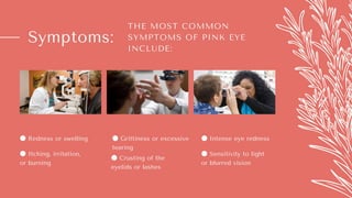 Symptoms:
THE MOST COMMON
SYMPTOMS OF PINK EYE
INCLUDE:
● Redness or swelling
● Itching, irritation,
or burning
● Grittiness or excessive
tearing
● Crusting of the
eyelids or lashes
● Sensitivity to light
or blurred vision
● Intense eye redness
 