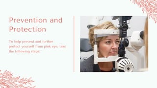 To help prevent and further
protect yourself from pink eye, take
the following steps:
Prevention and
Protection
 