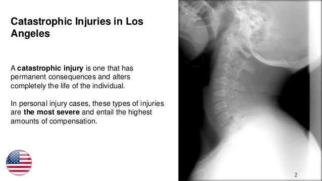 how-to-prove-catastrophic-injuries-in-a-personal-injury-case-2-638.jpg?cb=1497559129
