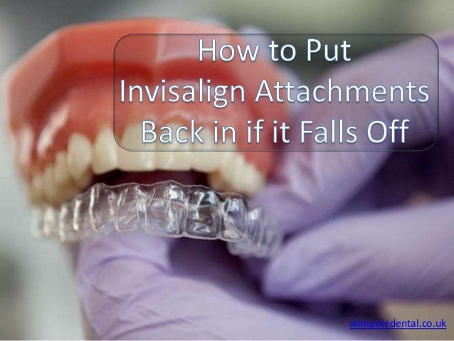 invisalign attachments