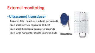 External monitoting
•Ultrasound transducer
Transmit fetal heart rate in beat per minute
Each small vertical square is 10 beat
Each small horizontal square 10 seconds
Each large horizontal square is one minute
 