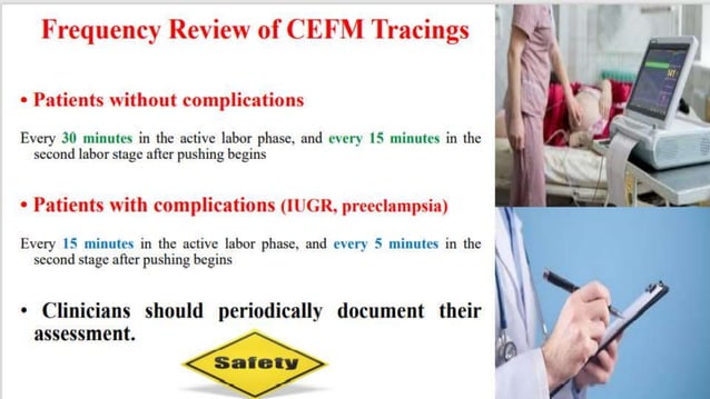 How to read a CTG دكتور صلاح رزق.pptx