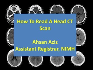 How To Read A Head CT
Scan
Ahsan Aziz
Assistant Registrar, NIMH
 