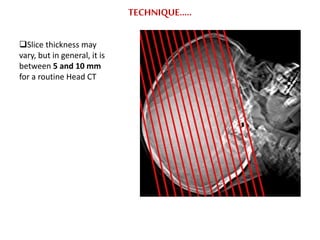 TECHNIQUE…..
Slice thickness may
vary, but in general, it is
between 5 and 10 mm
for a routine Head CT
 