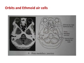 Orbits and Ethmoid air cells
 