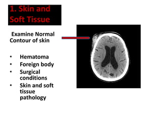 1. Skin and
Soft Tissue
Examine Normal
Contour of skin
• Hematoma
• Foreign body
• Surgical
conditions
• Skin and soft
tissue
pathology
 
