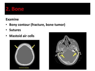 2. Bone
Examine
• Bony contour (fracture, bone tumor)
• Sutures
• Mastoid air cells
 