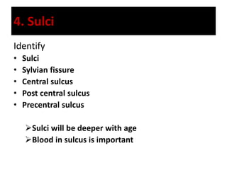 4. Sulci
Identify
• Sulci
• Sylvian fissure
• Central sulcus
• Post central sulcus
• Precentral sulcus
Sulci will be deeper with age
Blood in sulcus is important
 