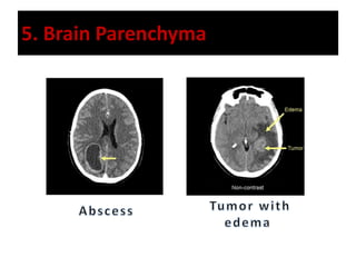 5. Brain Parenchyma
 