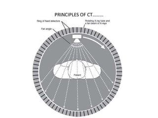 PRINCIPLES OF CT………
 