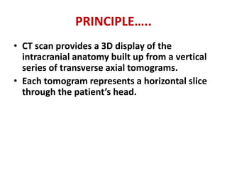 PRINCIPLE…..
• CT scan provides a 3D display of the
intracranial anatomy built up from a vertical
series of transverse axial tomograms.
• Each tomogram represents a horizontal slice
through the patient’s head.
 