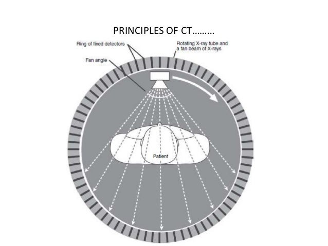 How To Read A Head CT Scan