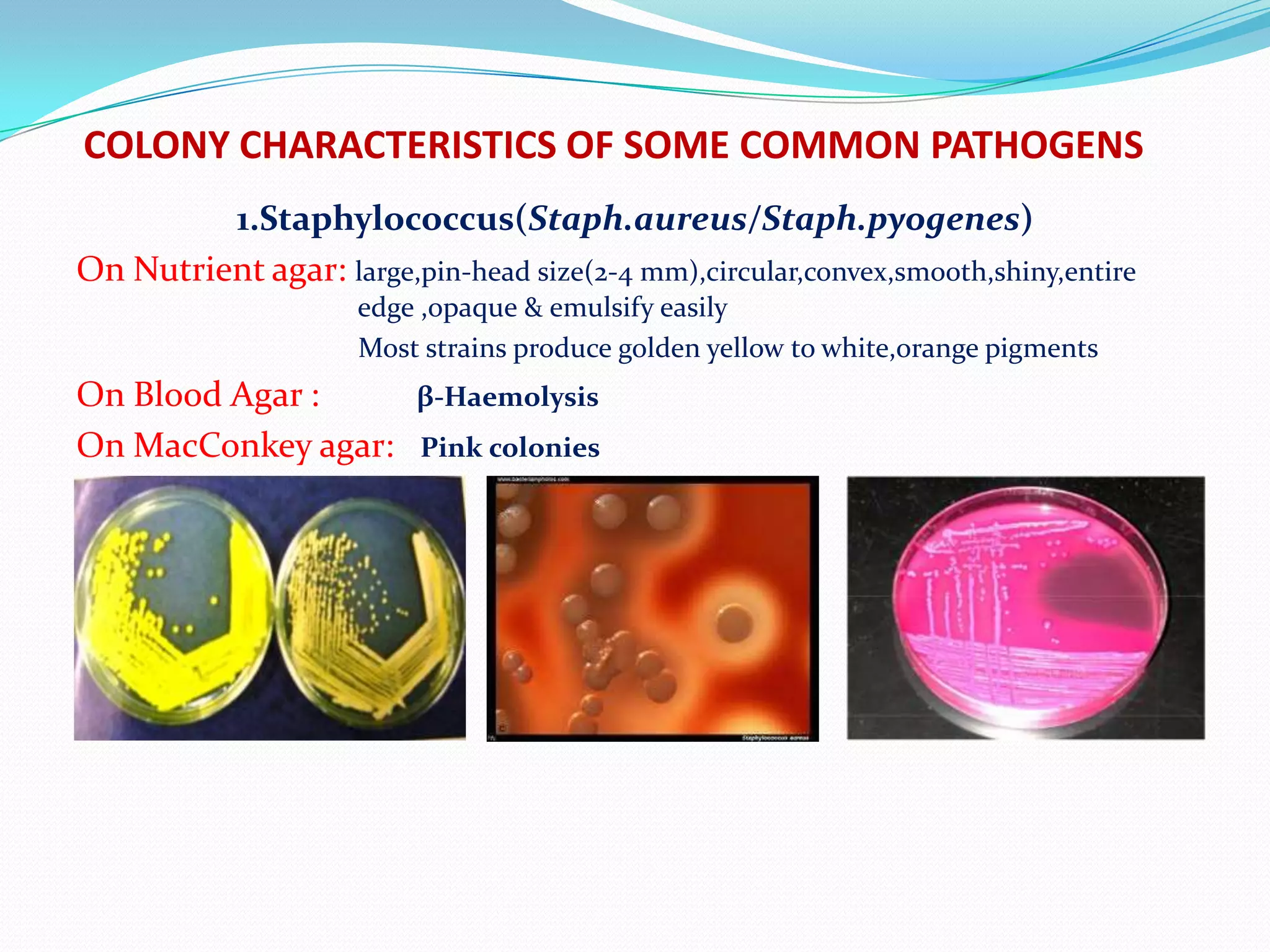 How to read a culture plate | PPTX