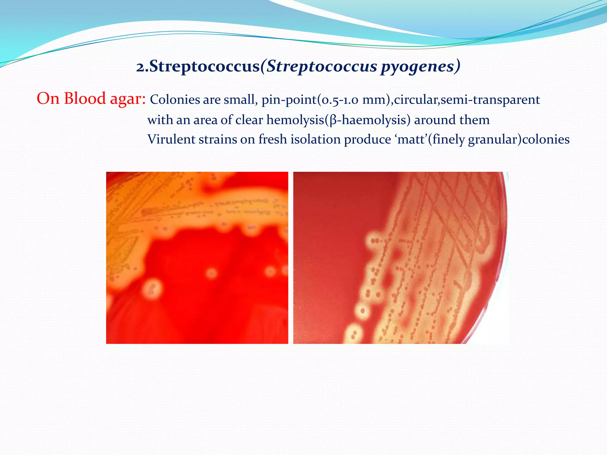 How to read a culture plate | PPTX