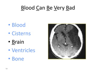Blood Can Be Very Bad
• Blood
• Cisterns
• Brain
• Ventricles
• Bone
64
 