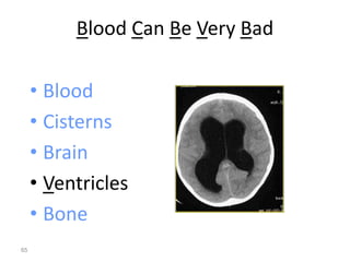 Blood Can Be Very Bad
• Blood
• Cisterns
• Brain
• Ventricles
• Bone
65
 