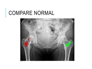 Normal Rug X Ray Interpretation of Musculoskeletal X-Ray | PPTX