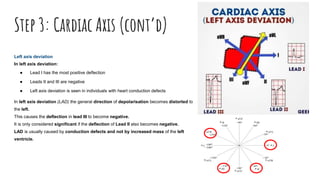 How to read an ecg | PPTX