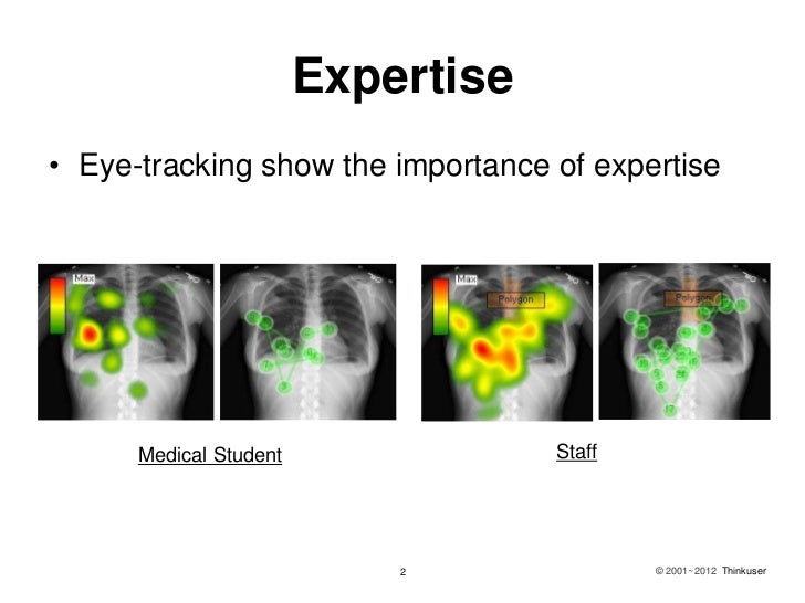 How to read a x rayeyetracking trainging