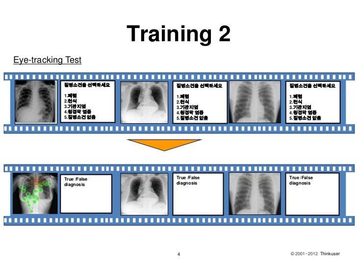 How to read a x rayeyetracking trainging
