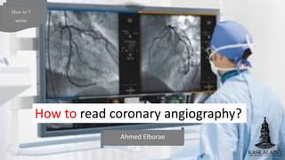Ahmed Elborae
How to ?
series
How to read coronary angiography?
 