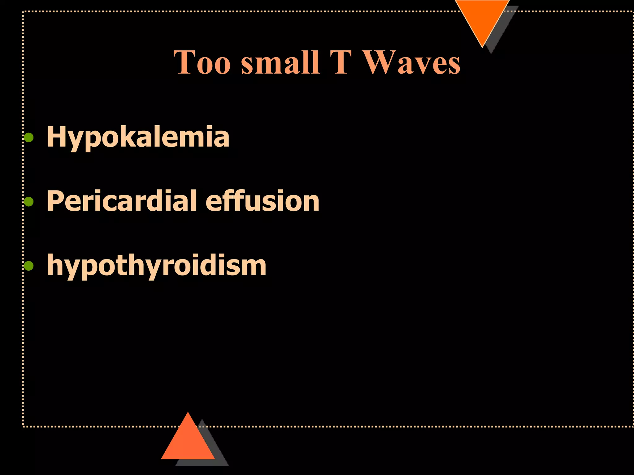 Too small T Waves
• Hypokalemia
• Pericardial effusion
• hypothyroidism
 