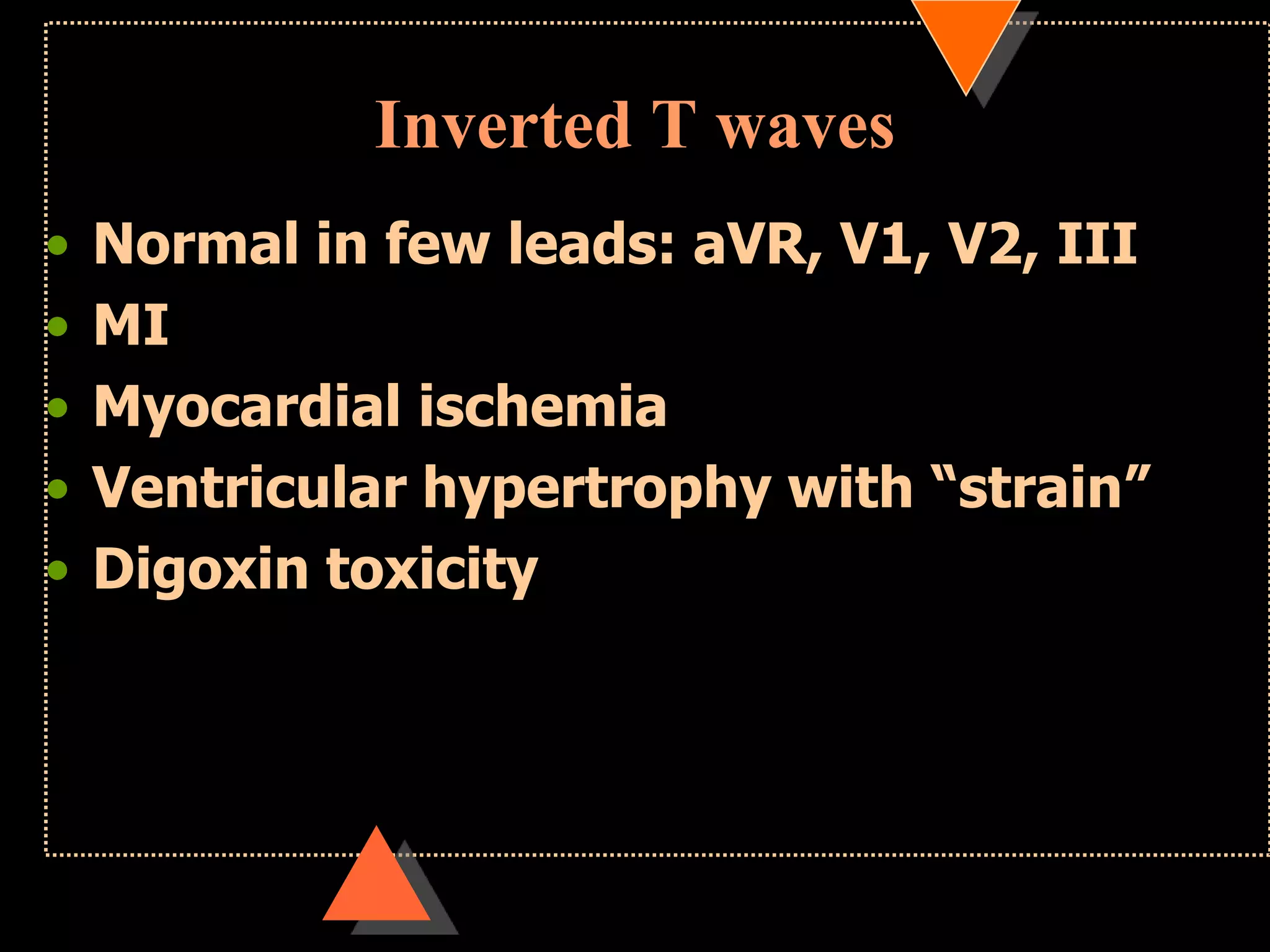 Inverted T waves
• Normal in few leads: aVR, V1, V2, III
• MI
• Myocardial ischemia
• Ventricular hypertrophy with “strain”
• Digoxin toxicity
 