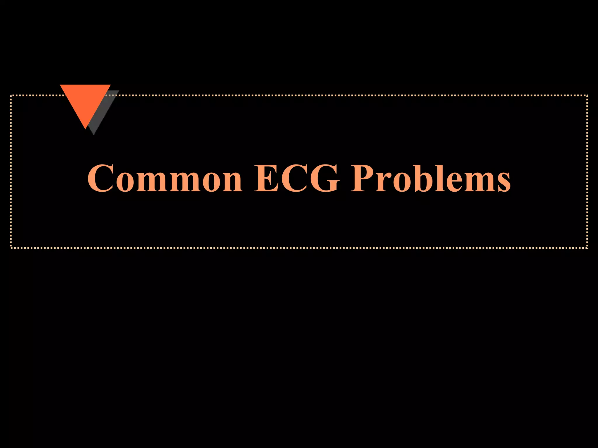 Common ECG Problems
 