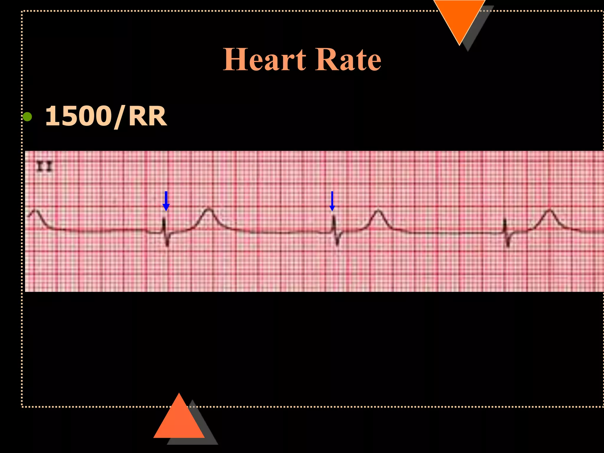 Heart Rate
• 1500/RR
 