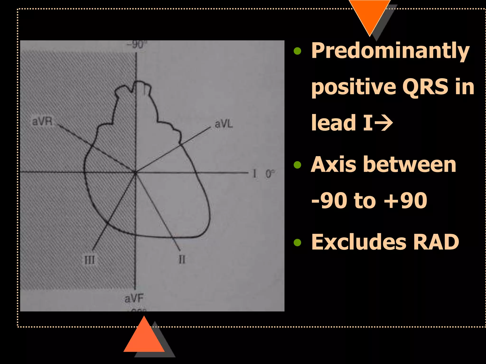 • Predominantly
positive QRS in
lead I
• Axis between
-90 to +90
• Excludes RAD
 
