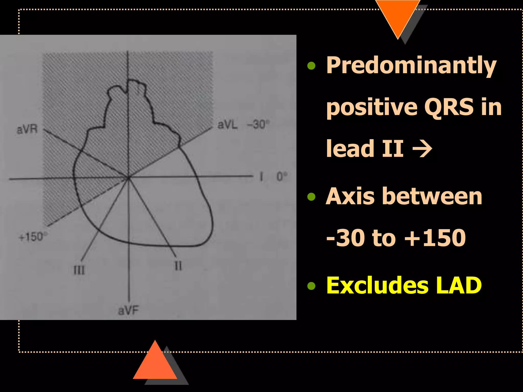 • Predominantly
positive QRS in
lead II 
• Axis between
-30 to +150
• Excludes LAD
 