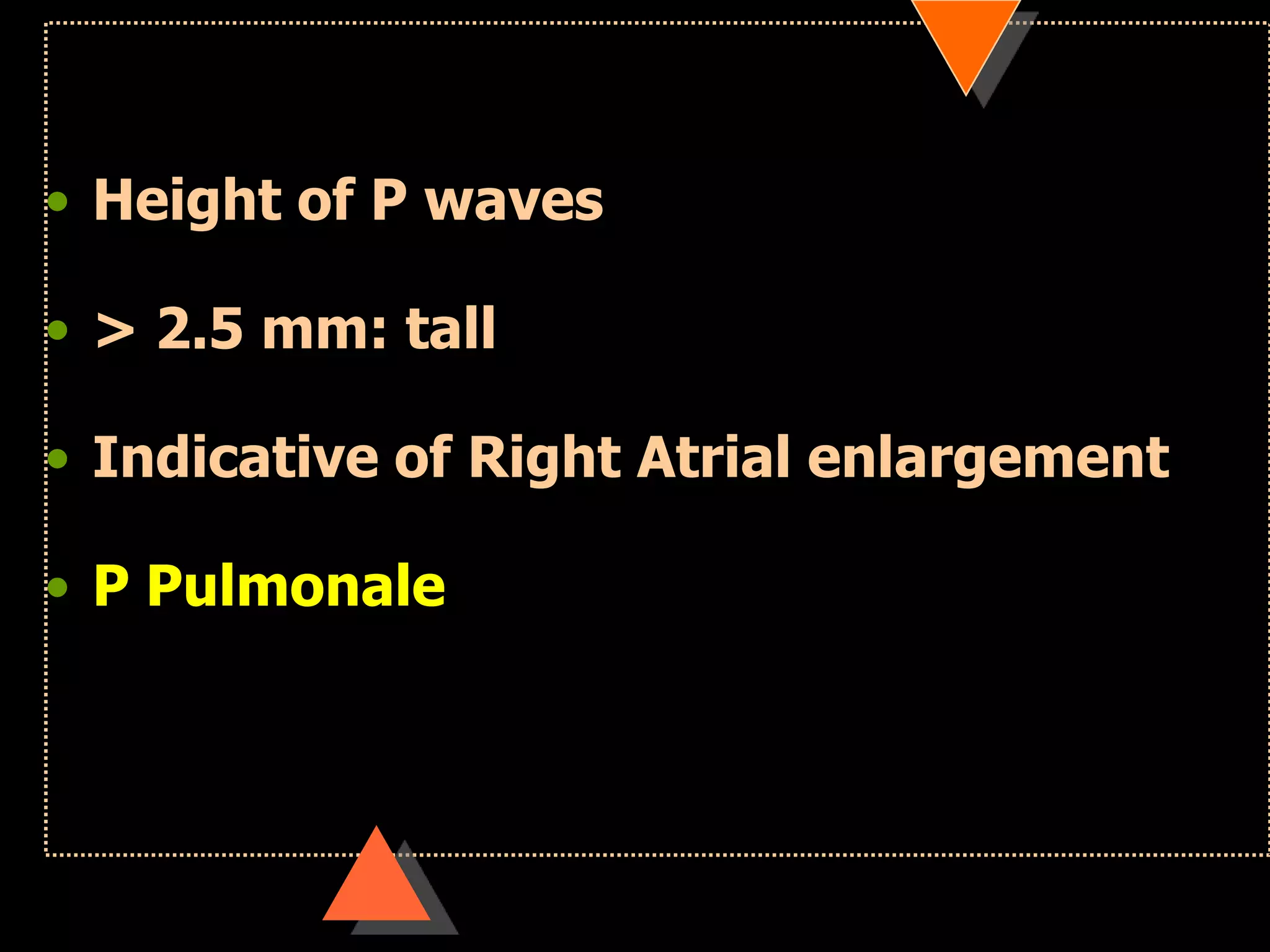 • Height of P waves
• > 2.5 mm: tall
• Indicative of Right Atrial enlargement
• P Pulmonale
 