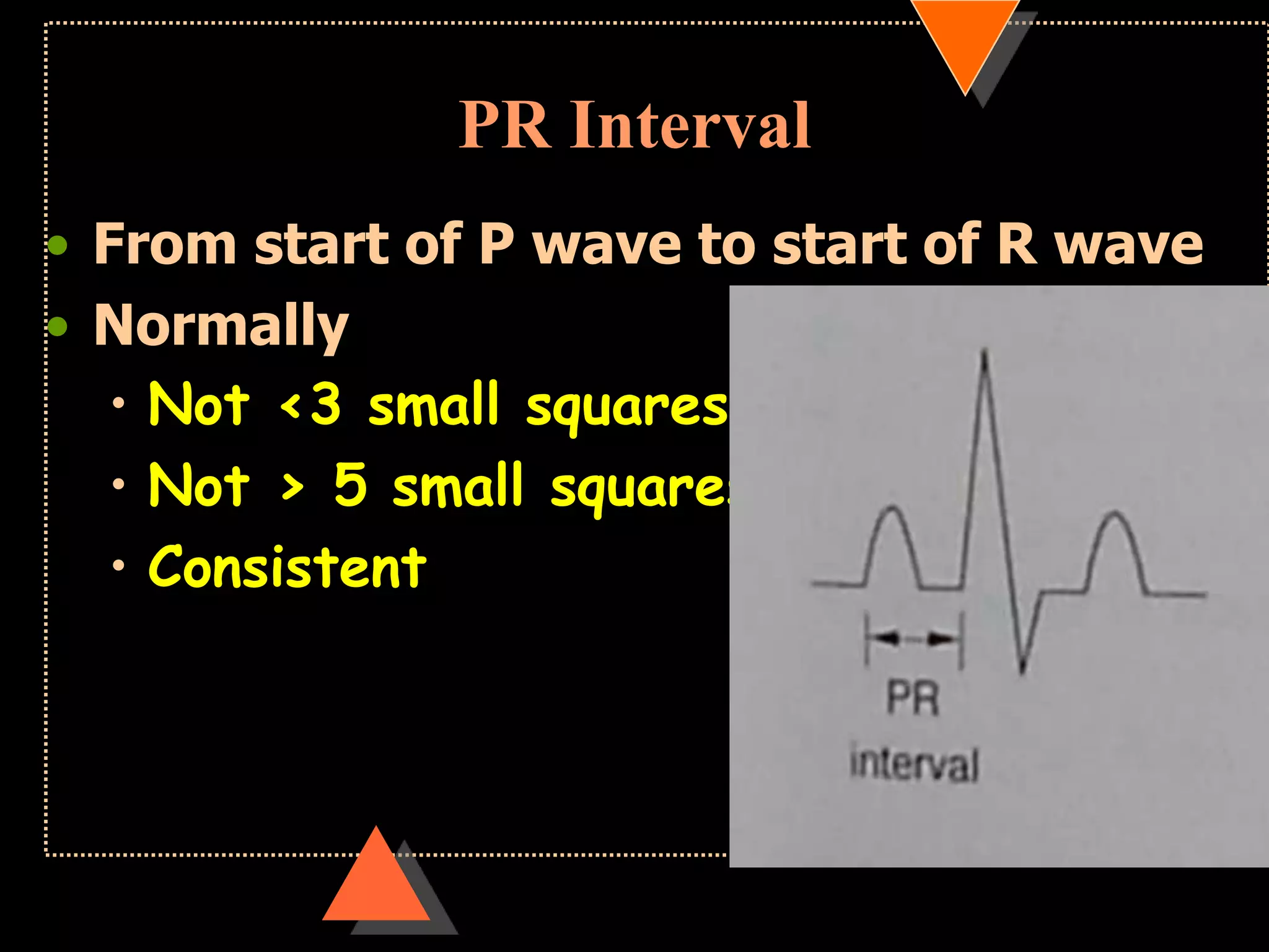 PR Interval
• From start of P wave to start of R wave
• Normally
• Not <3 small squares
• Not > 5 small squares
• Consistent
 