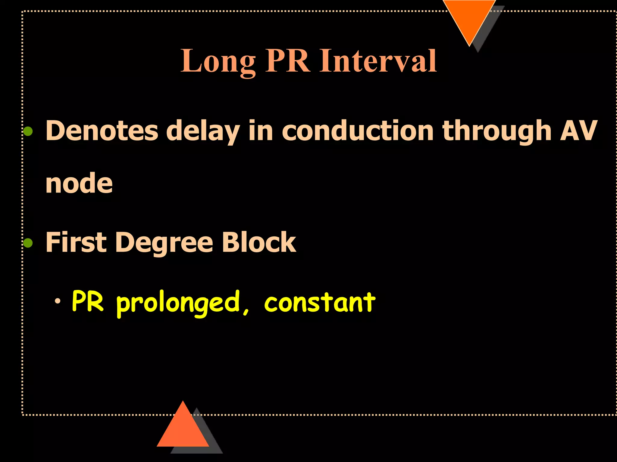 Long PR Interval
• Denotes delay in conduction through AV
node
• First Degree Block
• PR prolonged, constant
 