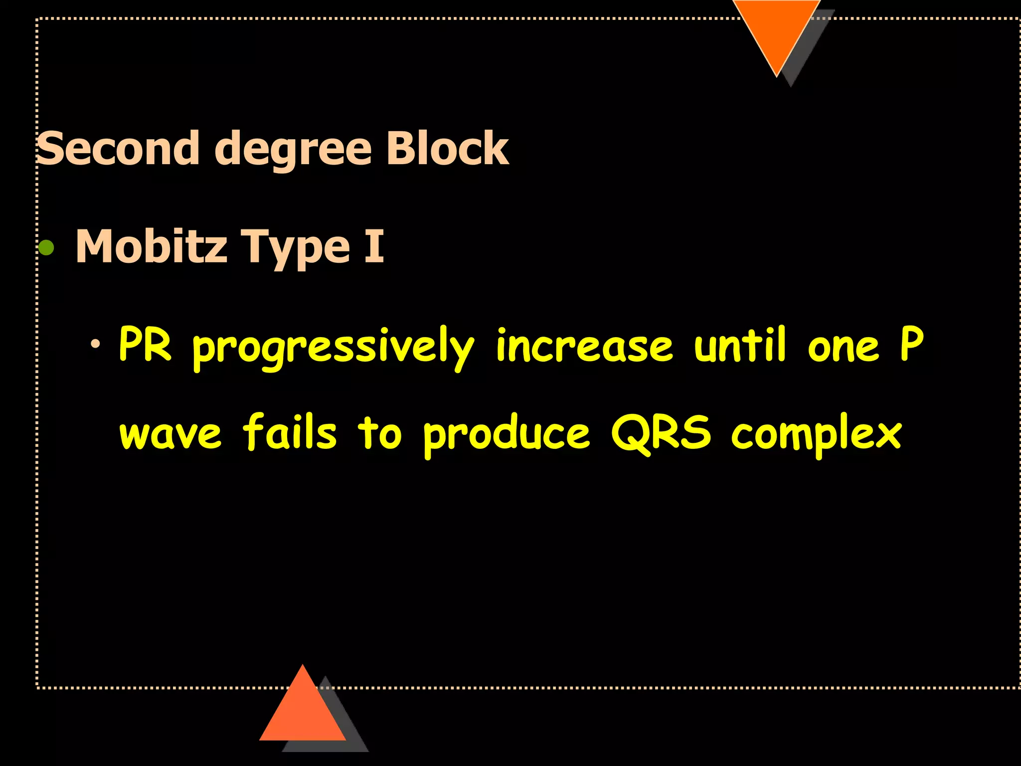 Second degree Block
• Mobitz Type I
• PR progressively increase until one P
wave fails to produce QRS complex
 