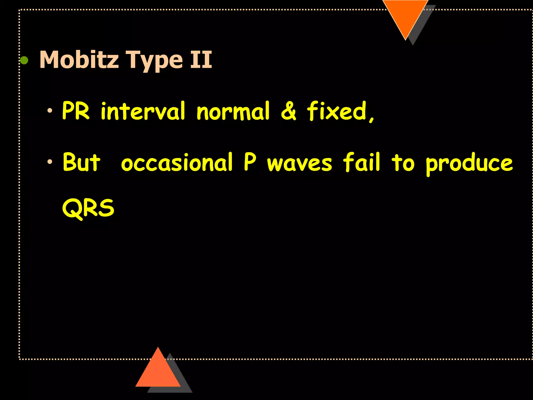 • Mobitz Type II
• PR interval normal & fixed,
• But occasional P waves fail to produce
QRS
 
