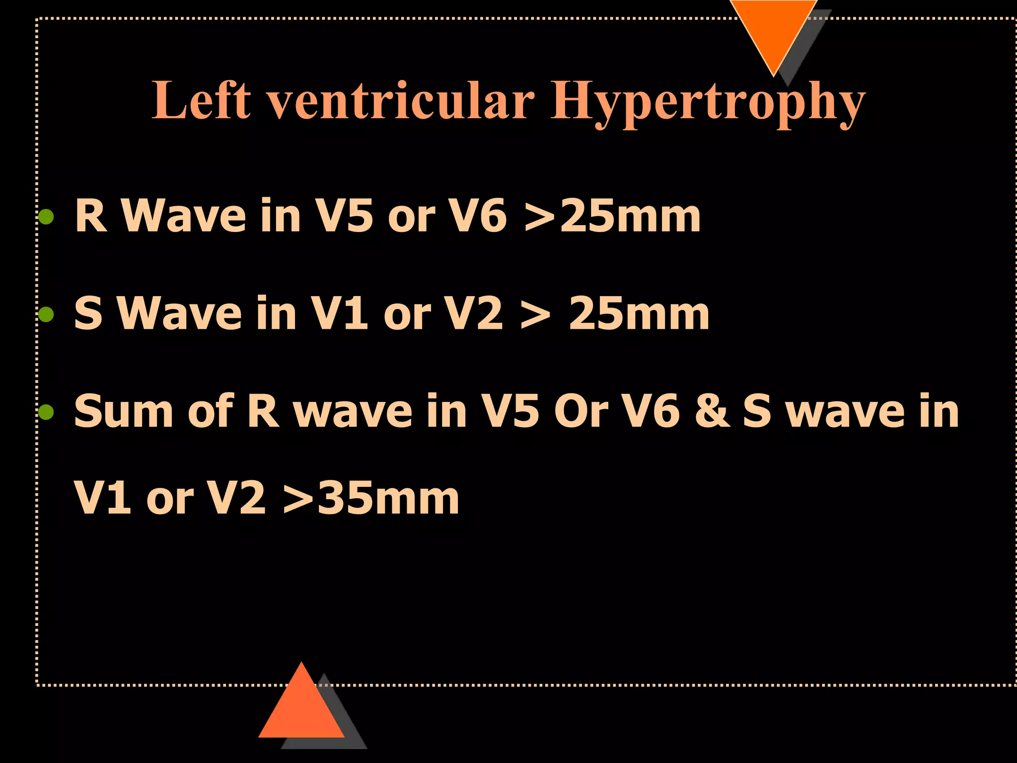 Left ventricular Hypertrophy
• R Wave in V5 or V6 >25mm
• S Wave in V1 or V2 > 25mm
• Sum of R wave in V5 Or V6 & S wave in
V1 or V2 >35mm
 