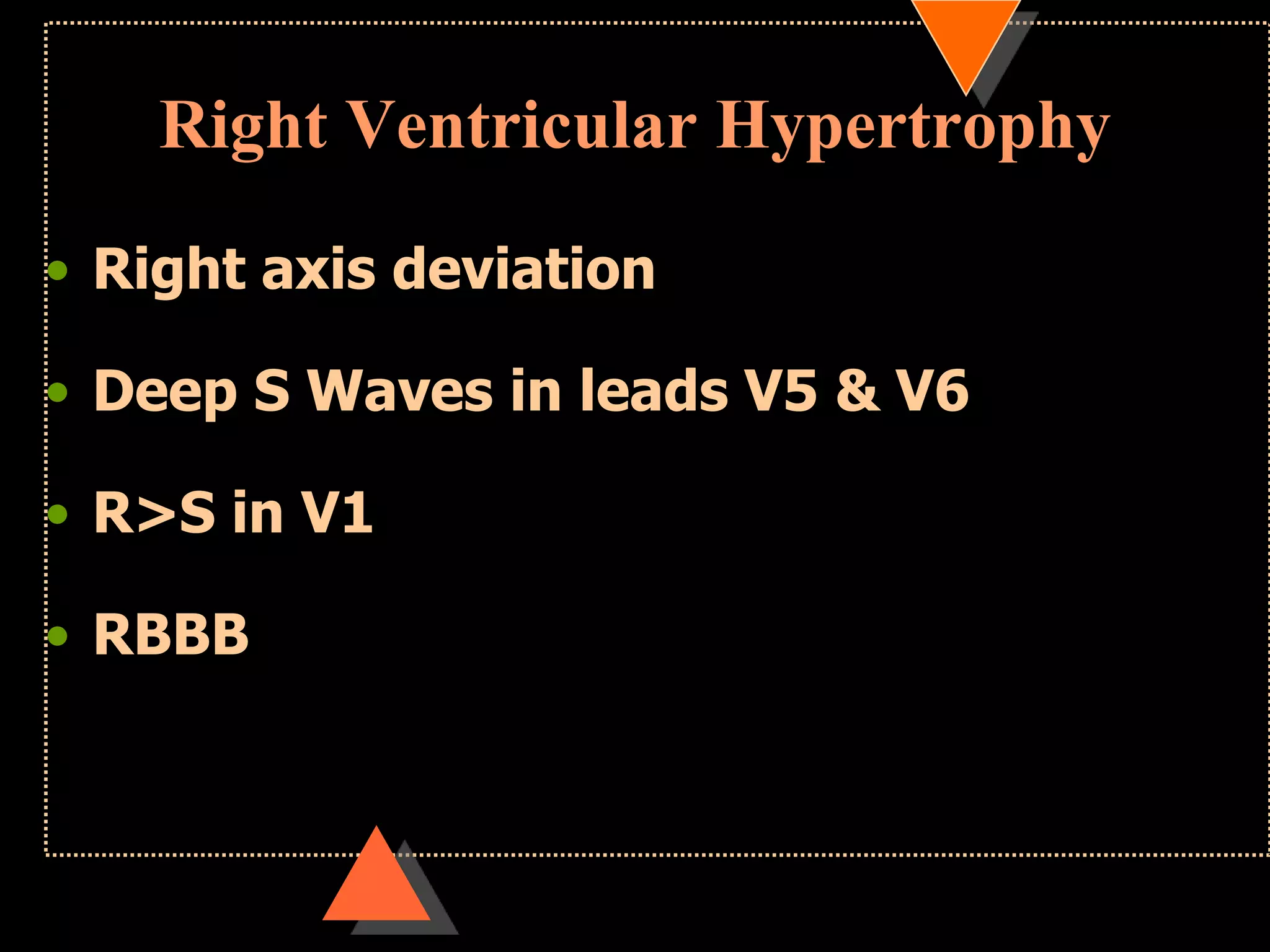 Right Ventricular Hypertrophy
• Right axis deviation
• Deep S Waves in leads V5 & V6
• R>S in V1
• RBBB
 