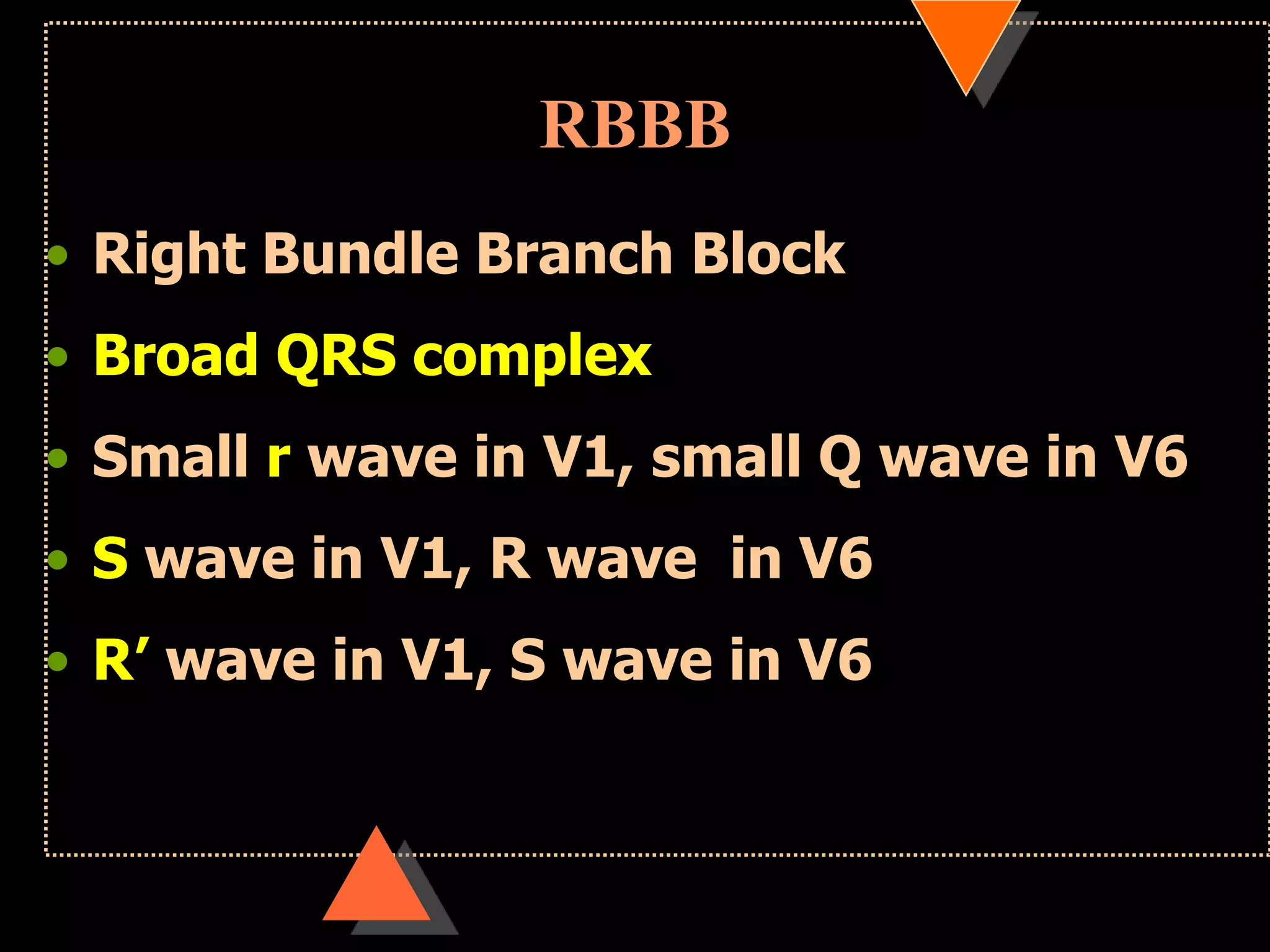 RBBB
• Right Bundle Branch Block
• Broad QRS complex
• Small r wave in V1, small Q wave in V6
• S wave in V1, R wave in V6
• R‟ wave in V1, S wave in V6
 