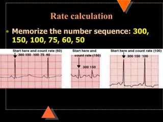 How to read ECG | PPSX