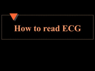 How to read ECG
 