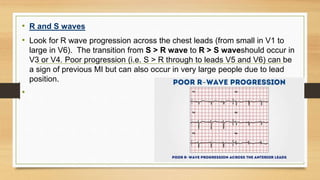 How to read ecg (basic ecg findings) | PPTX