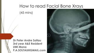How to read Facial Bone Xrays
(45 mins)
Dr Peter Andre Soltau
3rd year A&E Resident
UWI Mona
P.A.SOLTAU@GMAIL.com
 