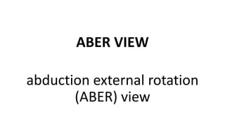 ABER VIEW
abduction external rotation
(ABER) view
 